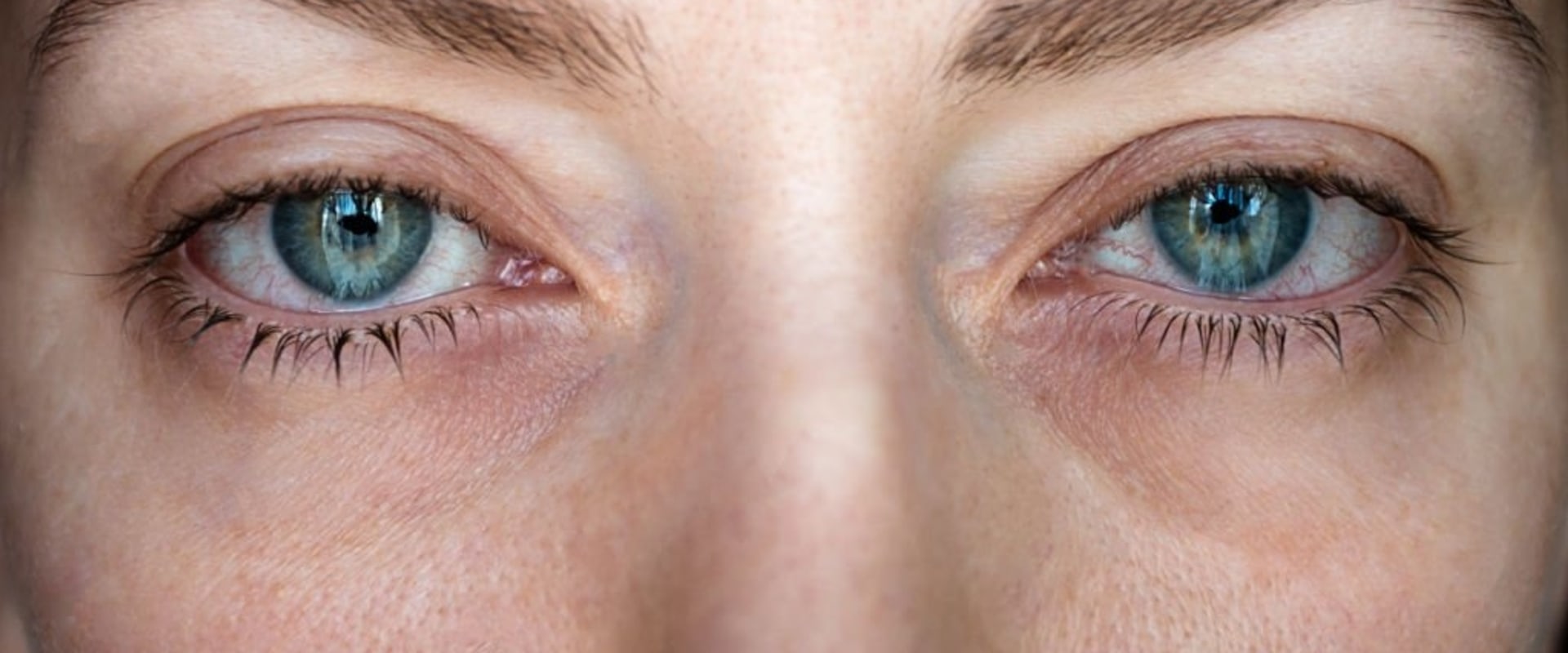How do you know if your allergic to eyelash extensions?