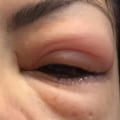 Are fake eyelashes safe?