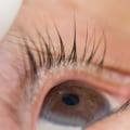 How long do eyelash extension allergies last?