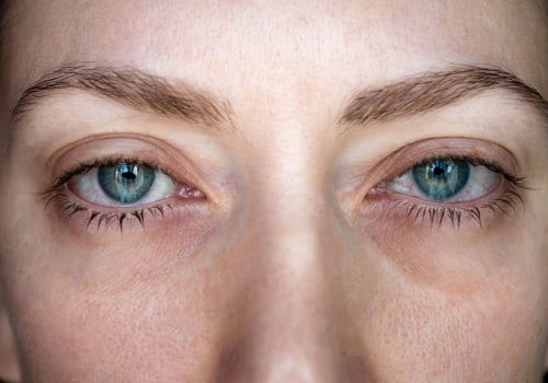 How do you know if your allergic to eyelash extensions?